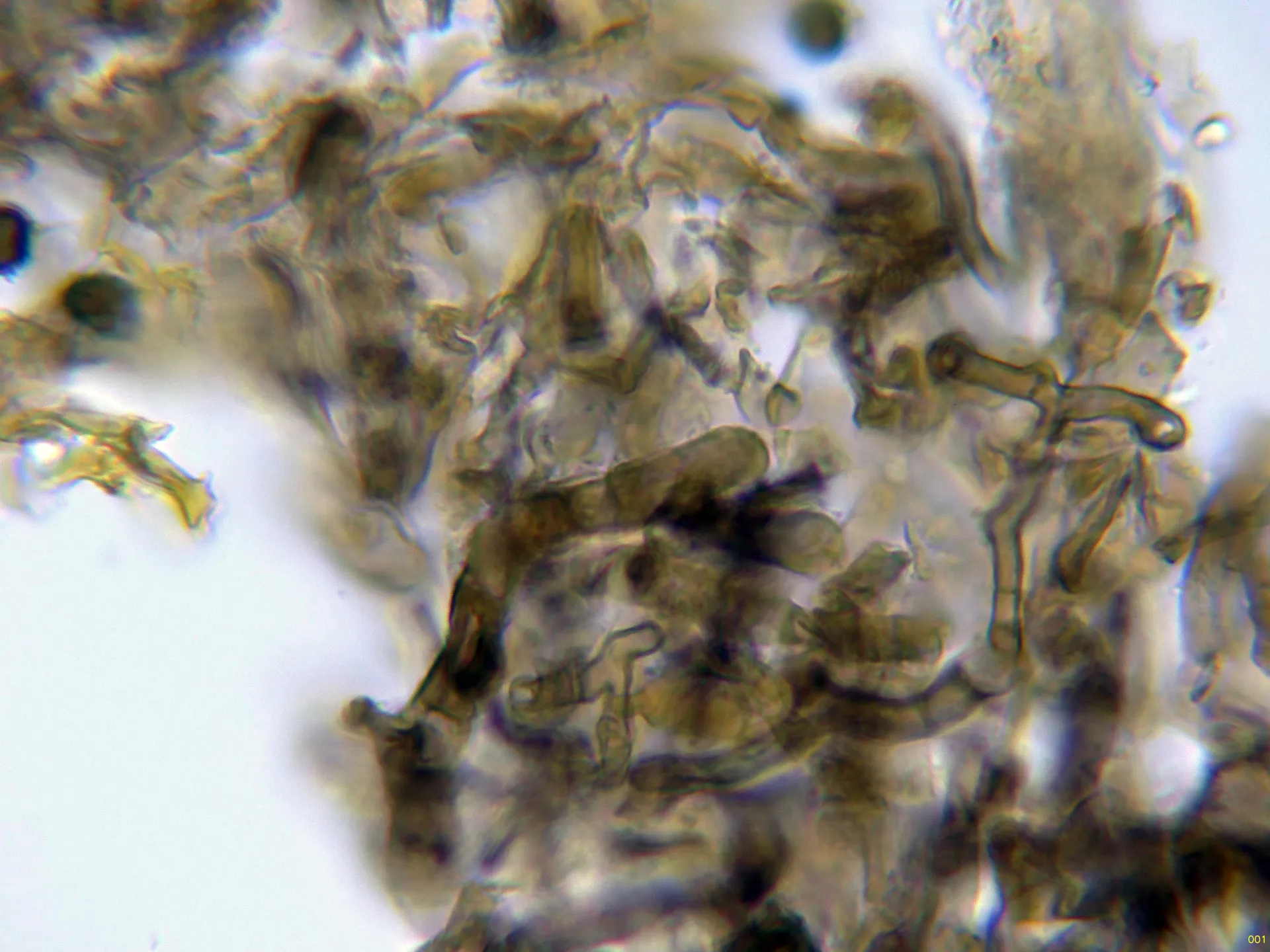 Microscopía de Tomentella alpina - 10 - Basidios KOH-001